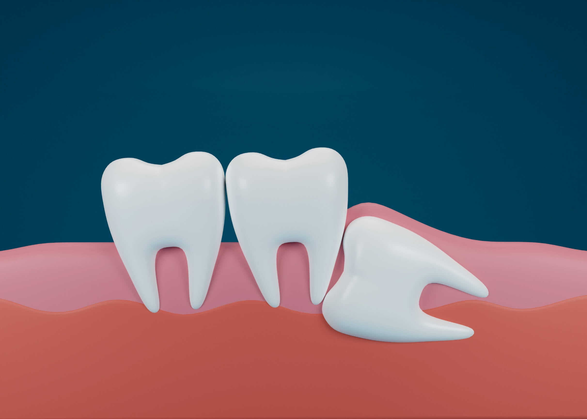Upper East Side Dentist - NY Dental Studio