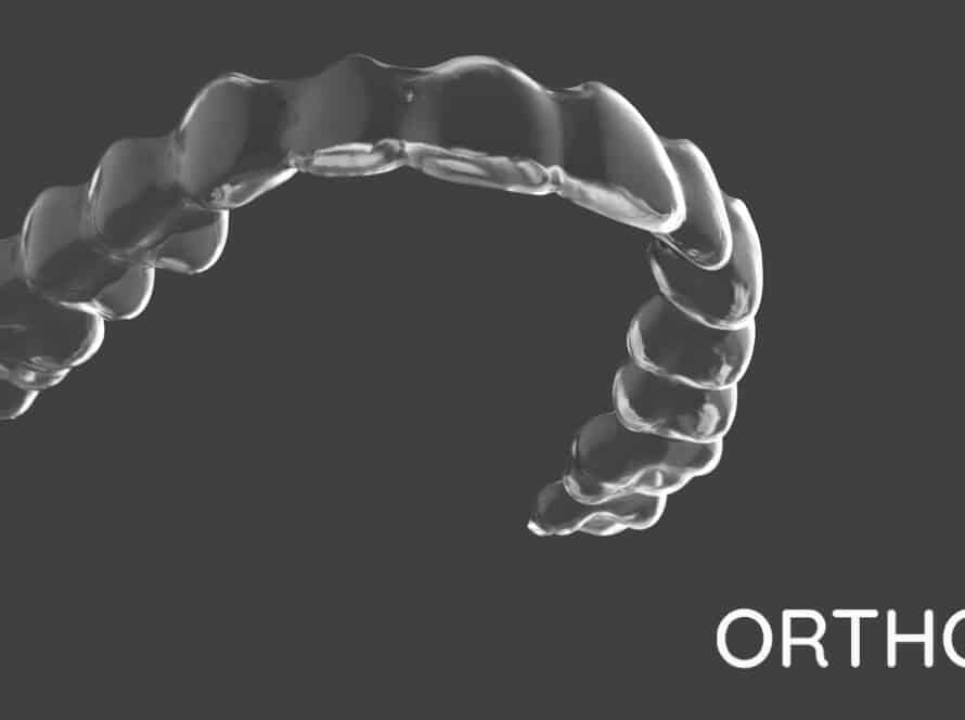 OrthoFX Aligners